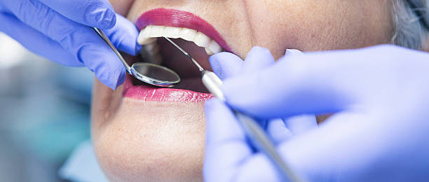 Best Mobile Emergency Dentist in Elmo, TX
