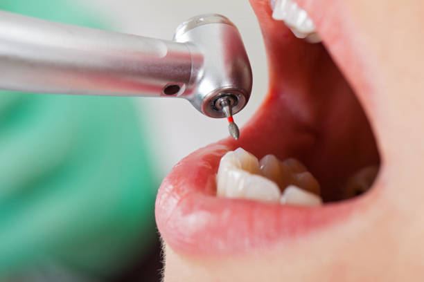 Best Holiday Emergency Dentist in Elmo, TX